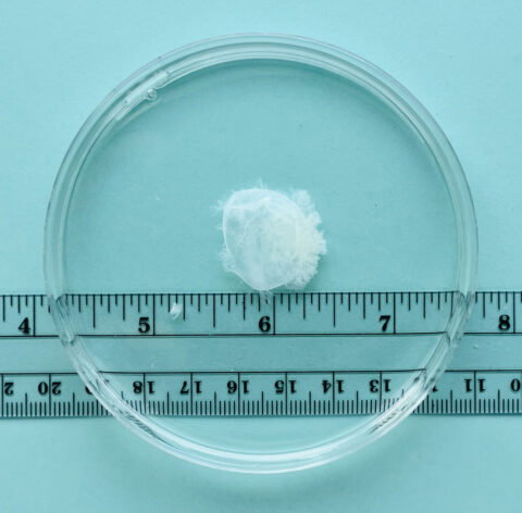 Tissue Chunk The Issue of Tissue - myanetwork