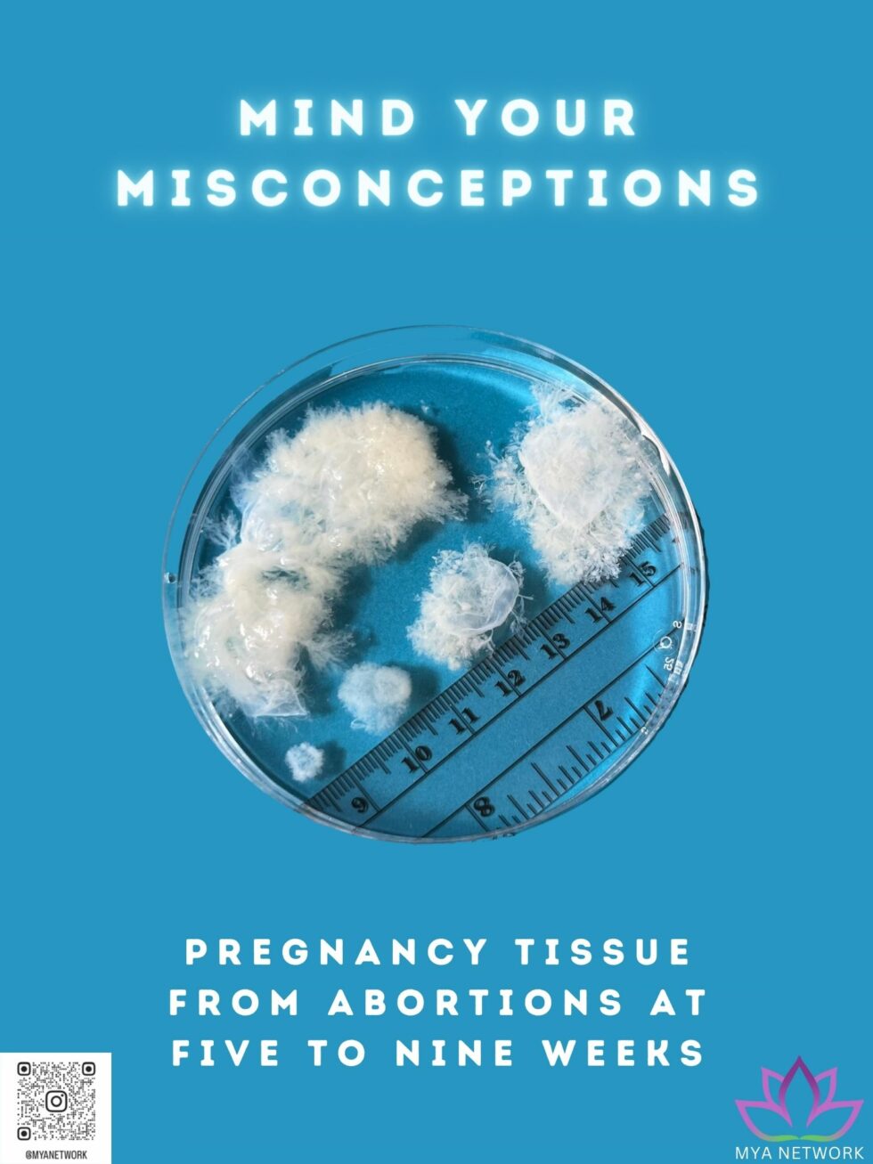 The Issue of Tissue - myanetwork
