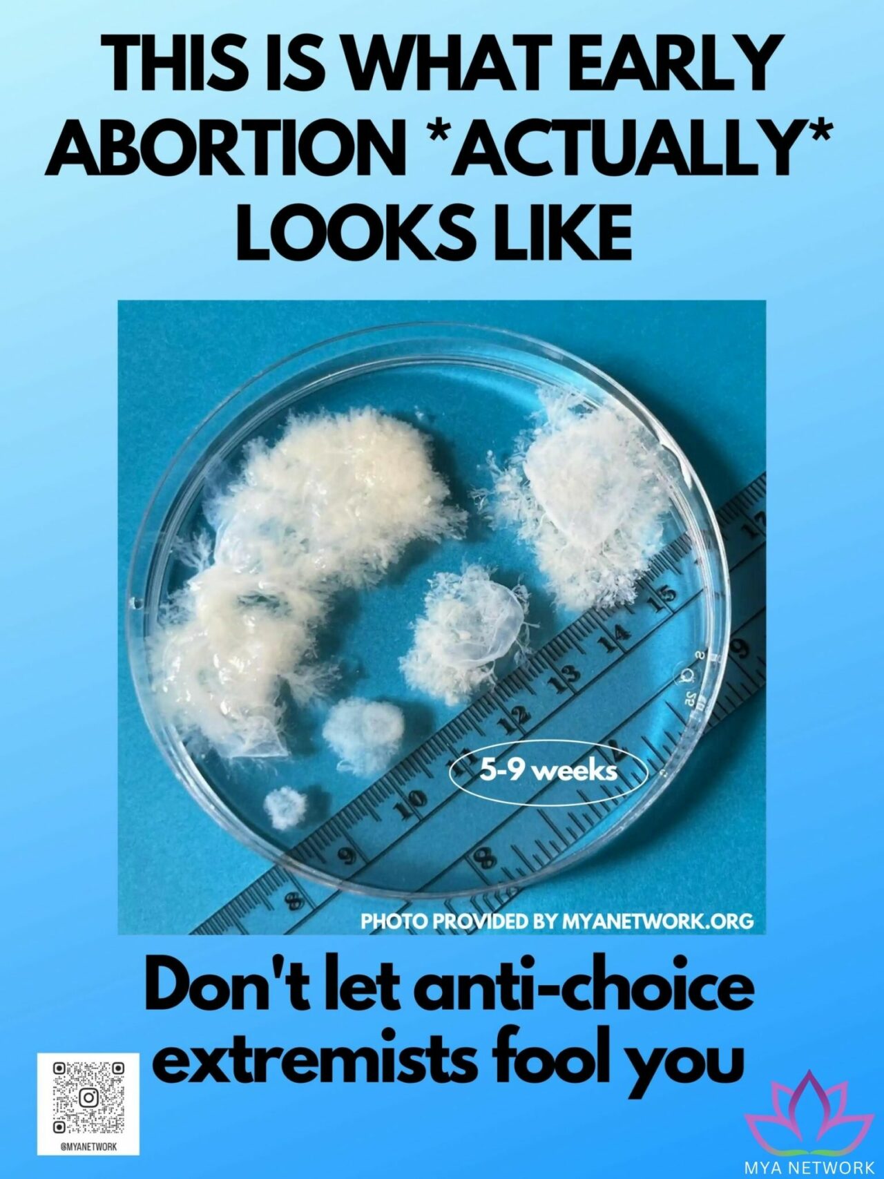 The Issue of Tissue - myanetwork